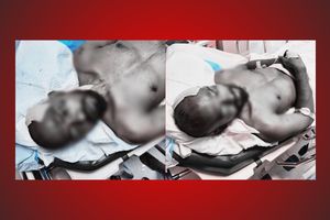 Athuhar taken into police custody after treatment